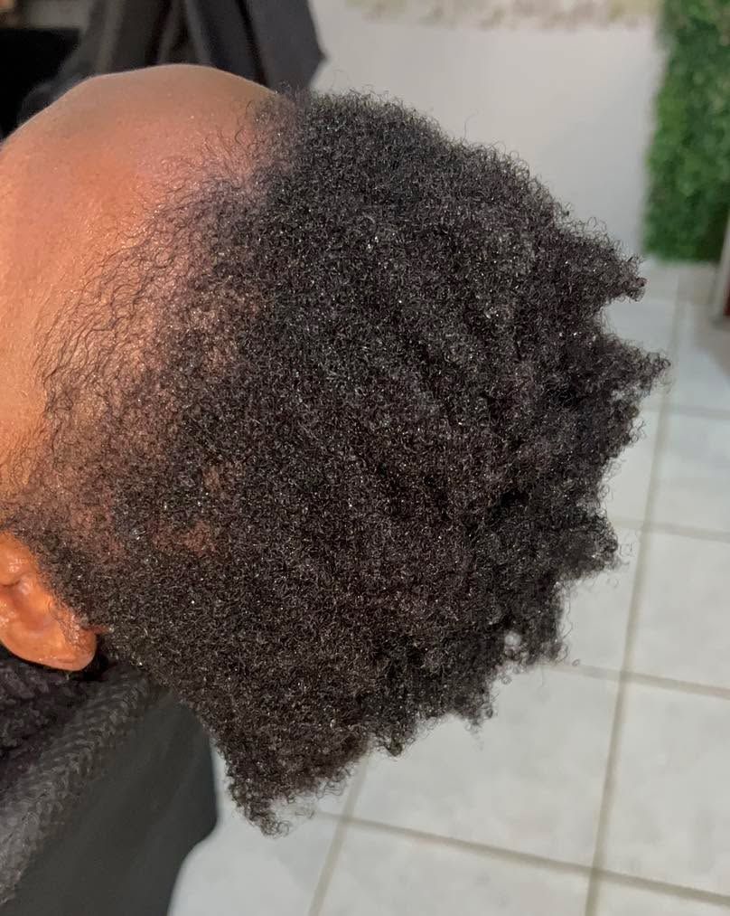 afro hair loss