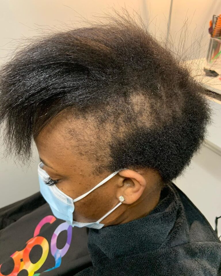 How To Stop Excessive Hair Shedding
