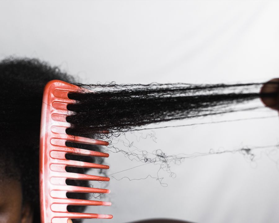 someone loosing hair from coming her hair