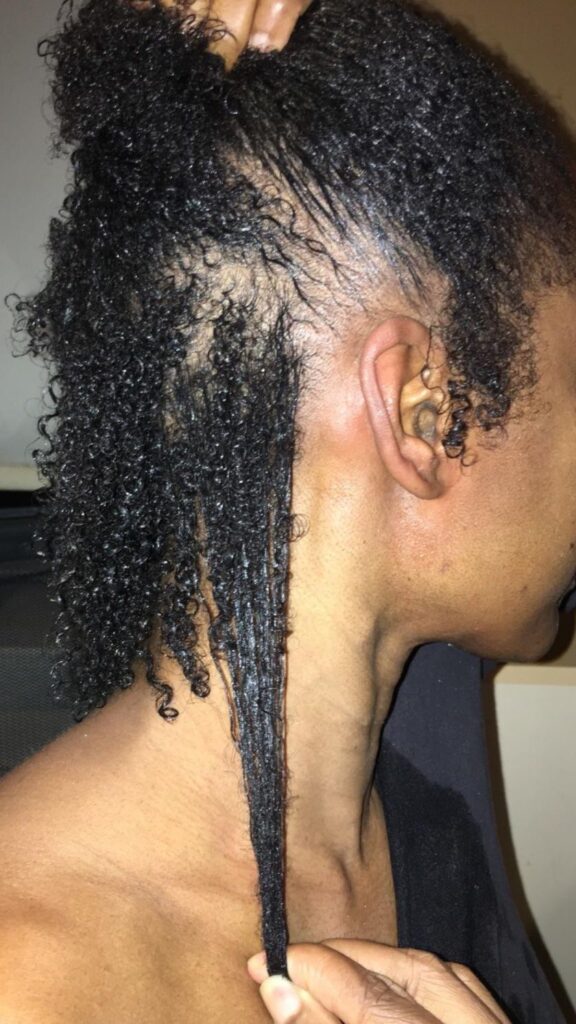 someone with curly hair shedding issue