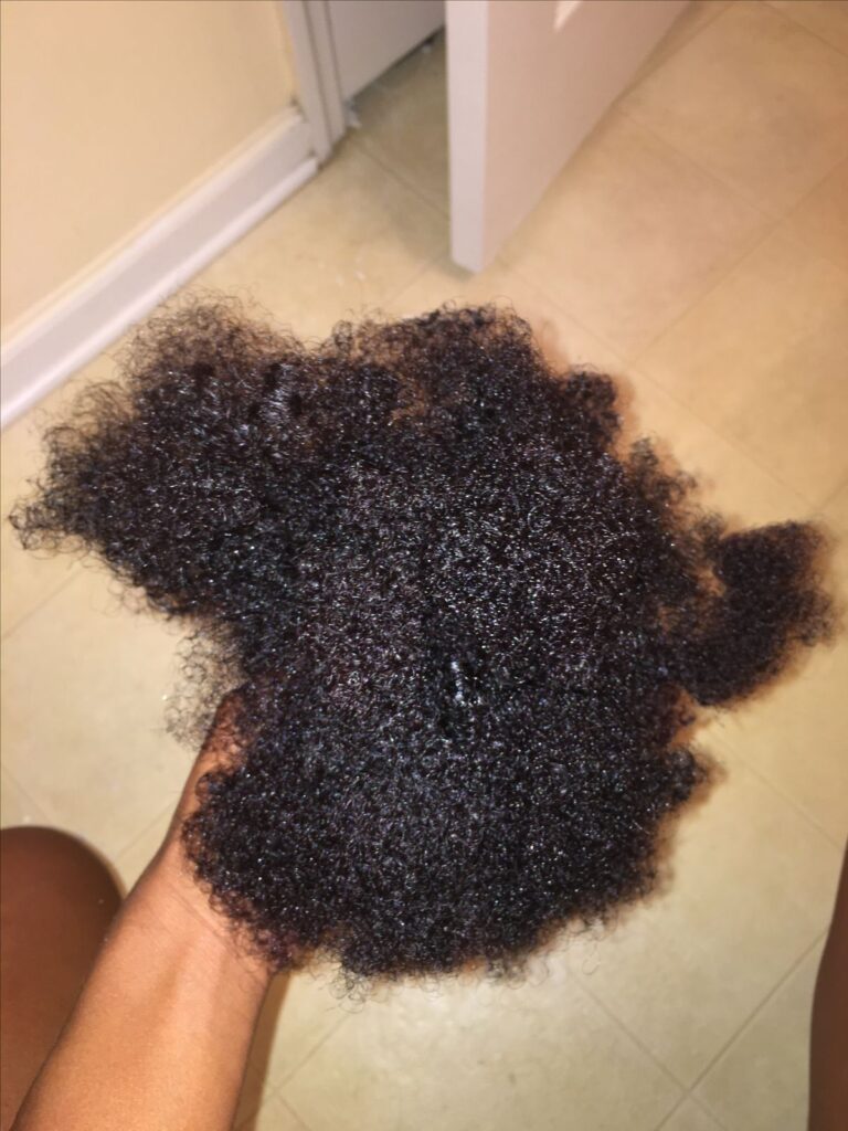 picture of excessive hair shedding