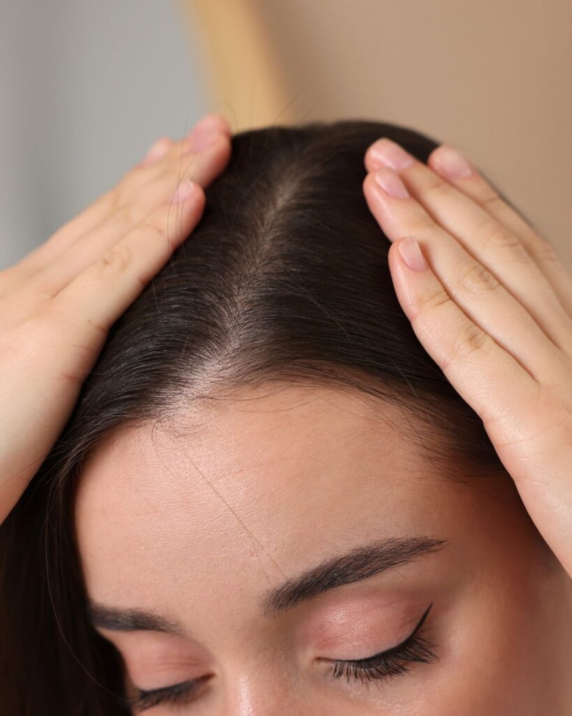 a girl showing her scalp