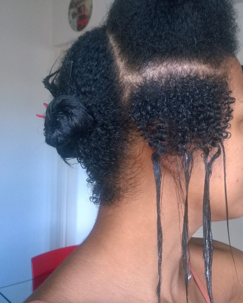 someone suffering from hair shedding