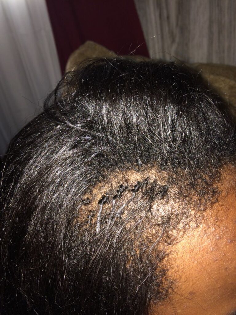picture of hair shedding
