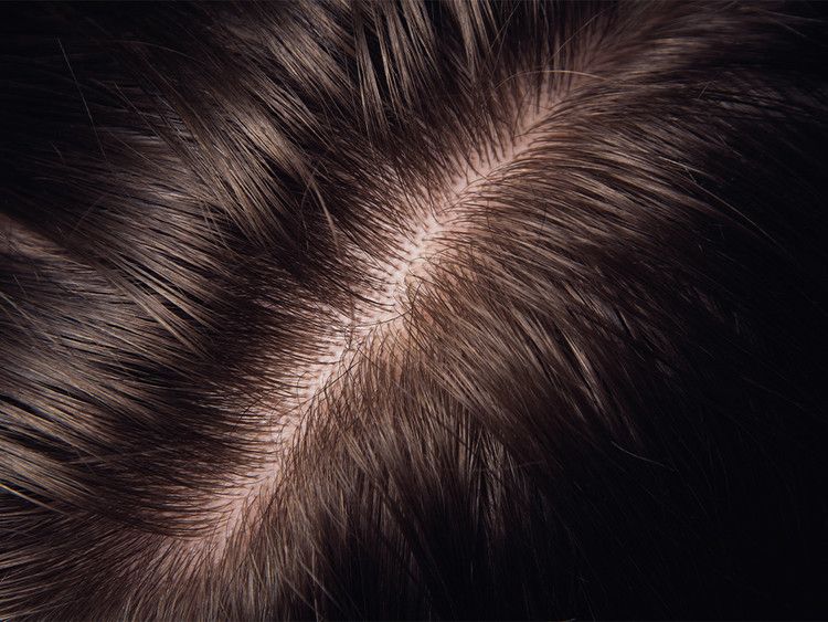 picture of a healthy scalp
