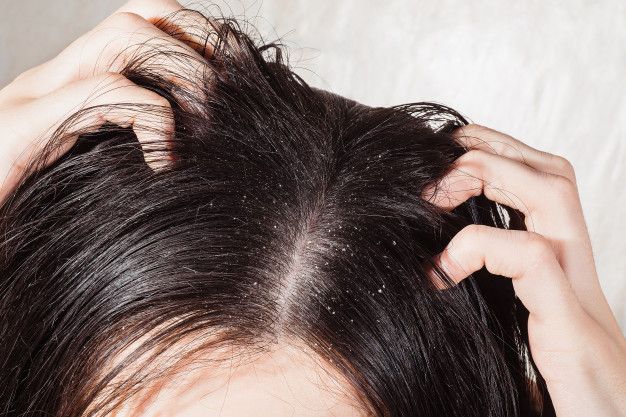 someone with itchy scalp problem