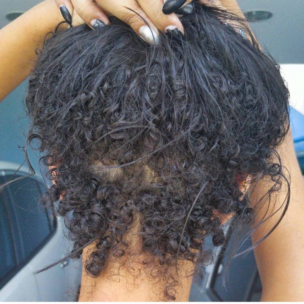 someone having hair shedding issue