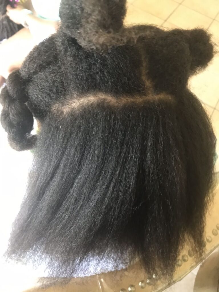someone with a dehydrated scalp
