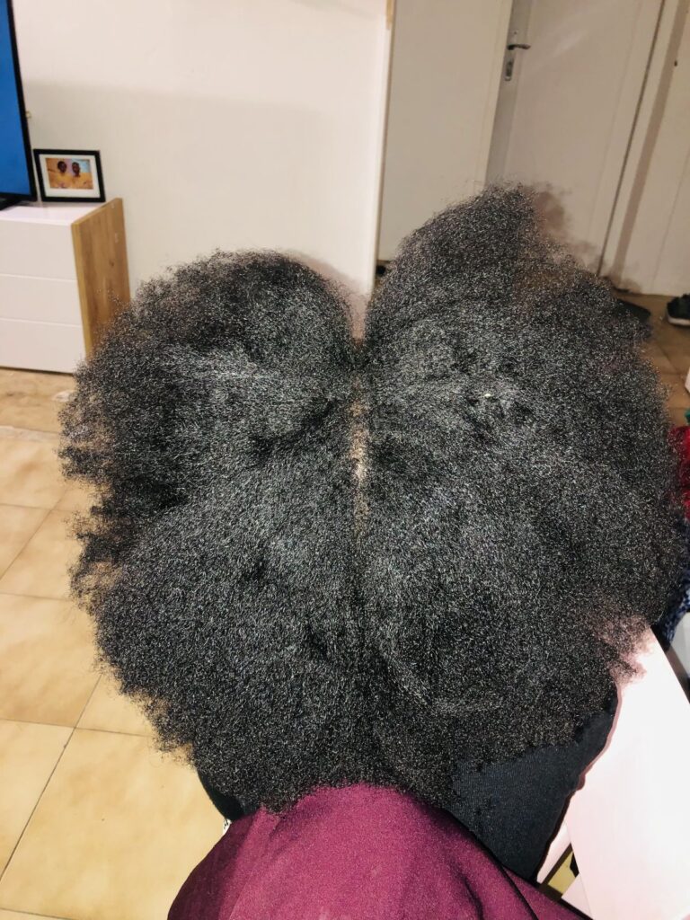 someone with dry scalp