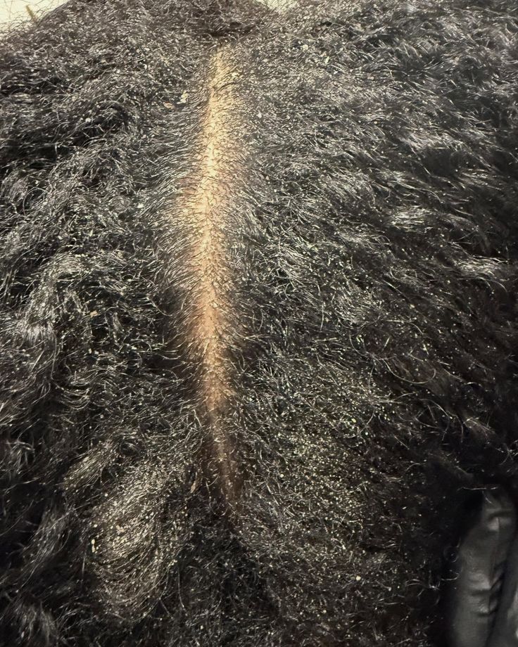 a dry scalp vs dehydrated scalp