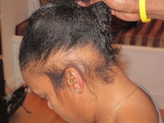 someone with hair breakage