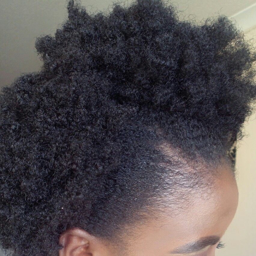 someone with a thin hairline