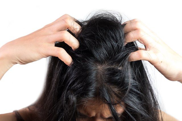 someone with itchy scalp