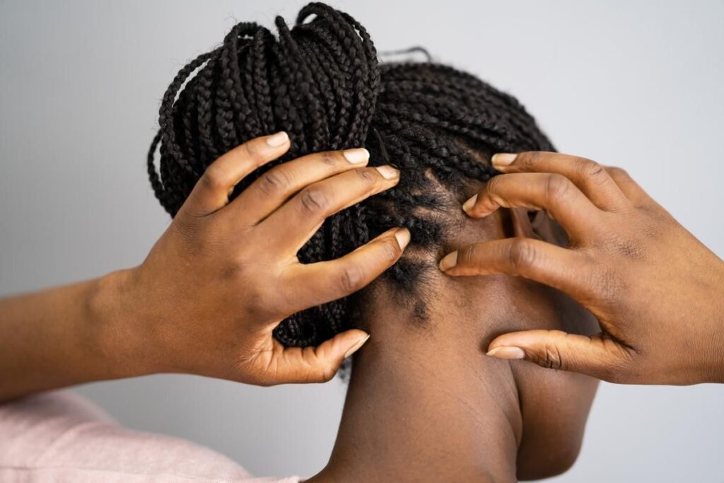 itchy scalp with protective hairstyle