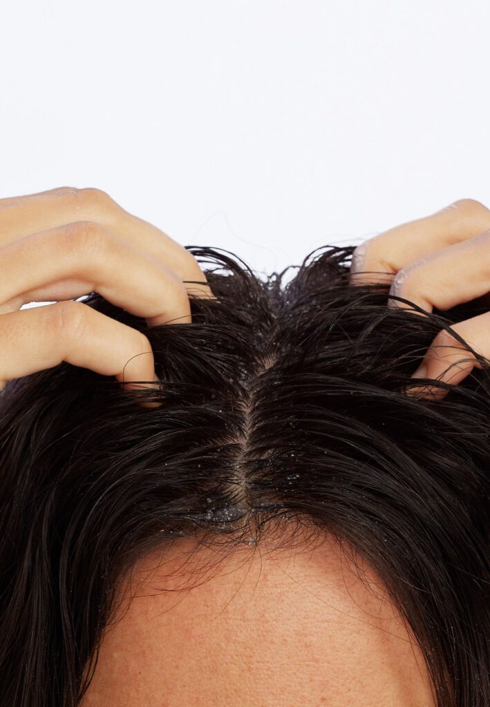 someone with itchy scalp