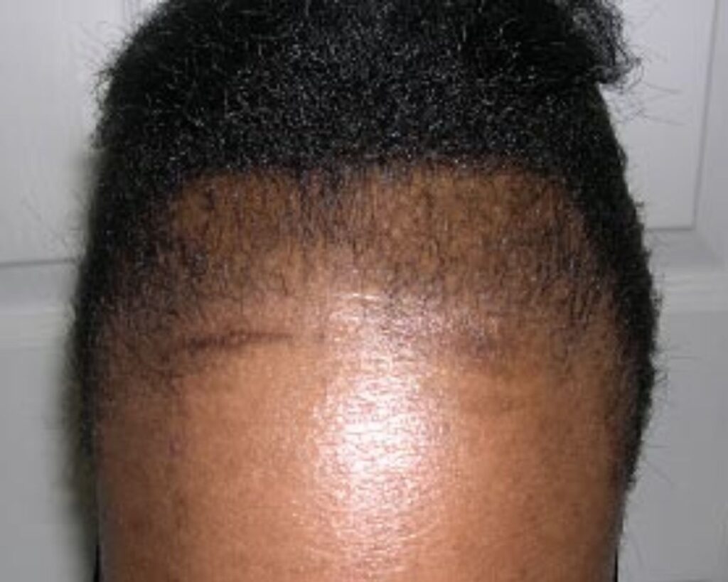 someone with a thin edges