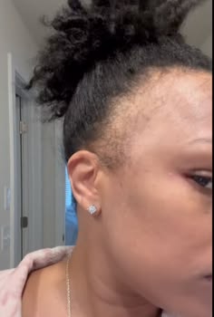 someone with thin edges